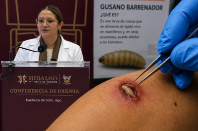 Gusano barrenador en Hidalgo: reportan siete casos humanos y tres en estudio